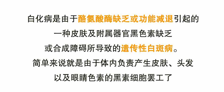白化病人，让我们共同呵护_15.jpg