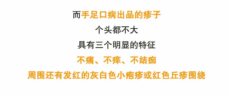 手足口到底是个啥捏_15.jpg