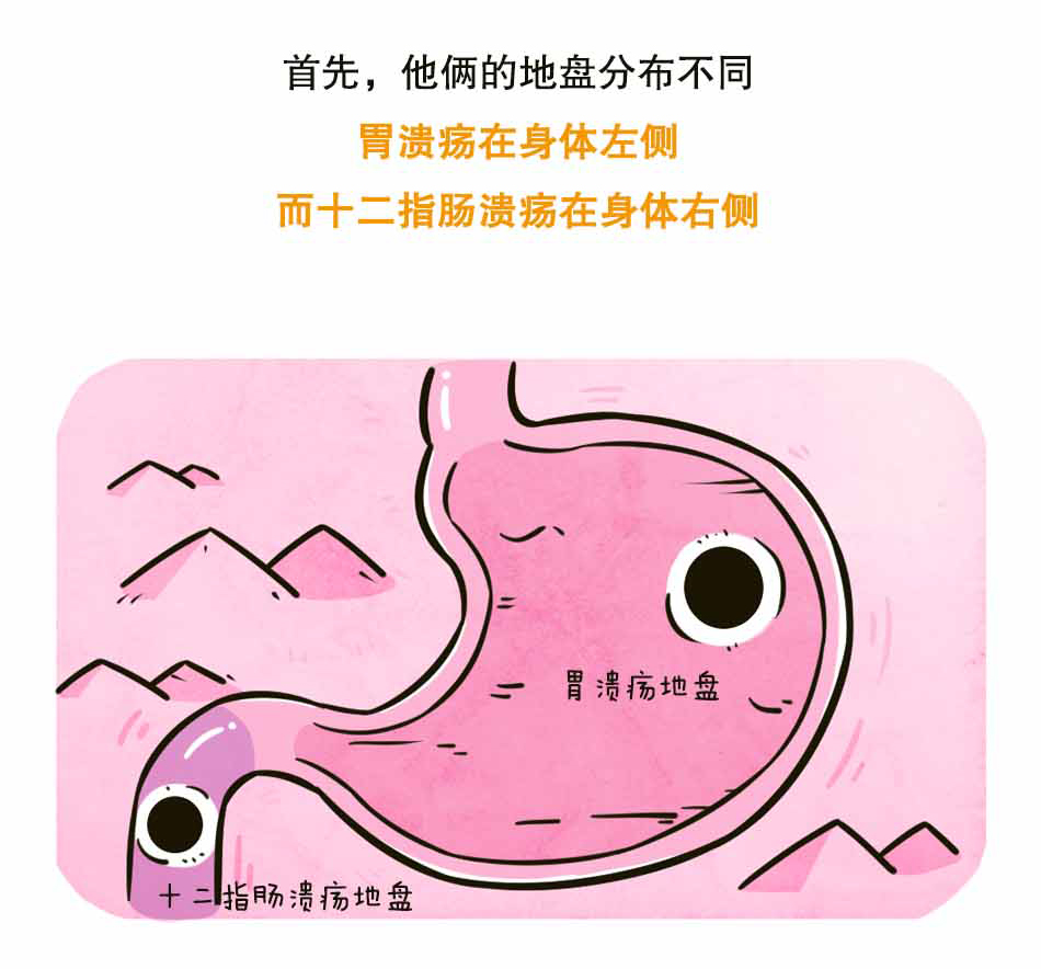 你可能得了个假的胃溃疡_04.jpg