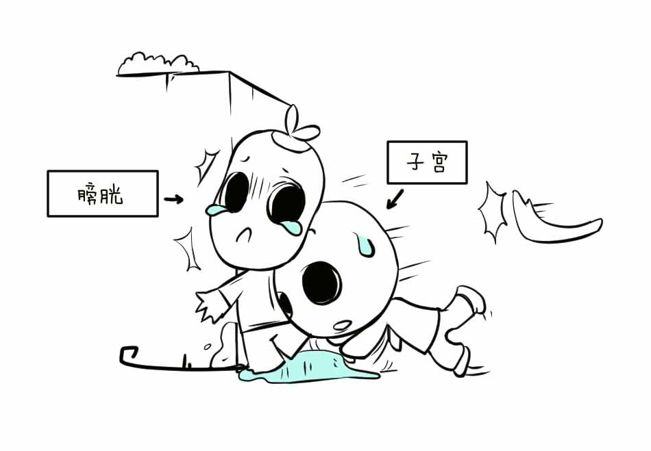 子宫脱垂听起来好吓人？_24.jpg