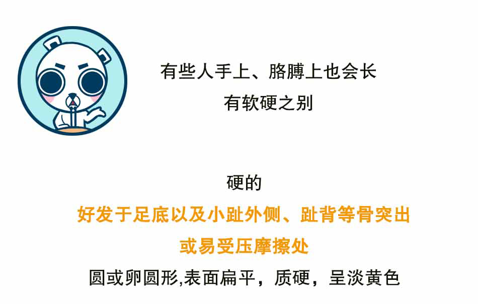 鸡眼很小，世界很大_10.jpg