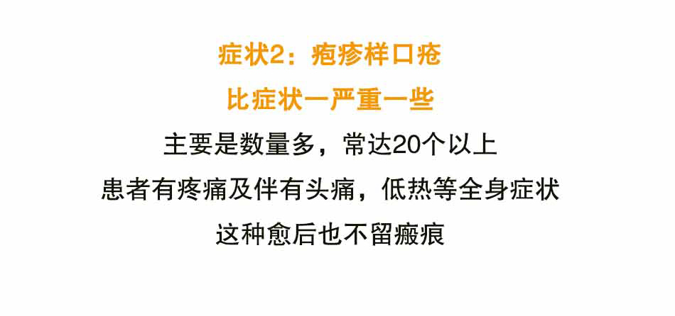 口腔溃疡怎么办_21.jpg