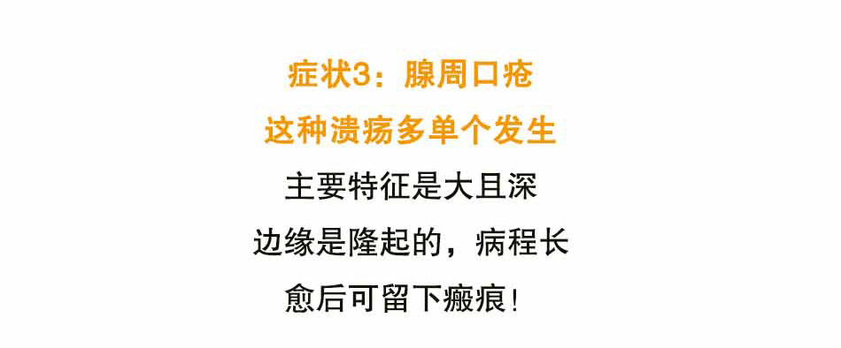口腔溃疡怎么办_23.jpg