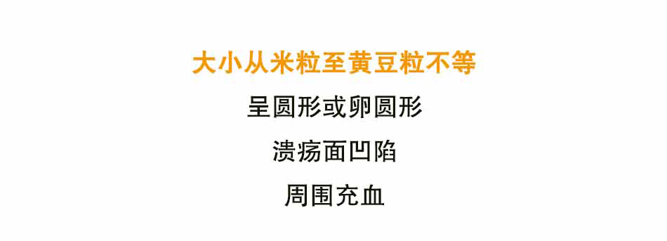 口腔溃疡怎么办_07.jpg