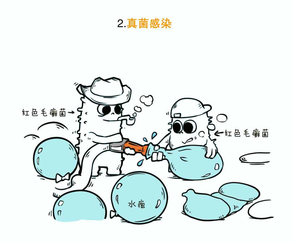 出汗很尴尬，没汗就有危险——汗疱疹_08.jpg