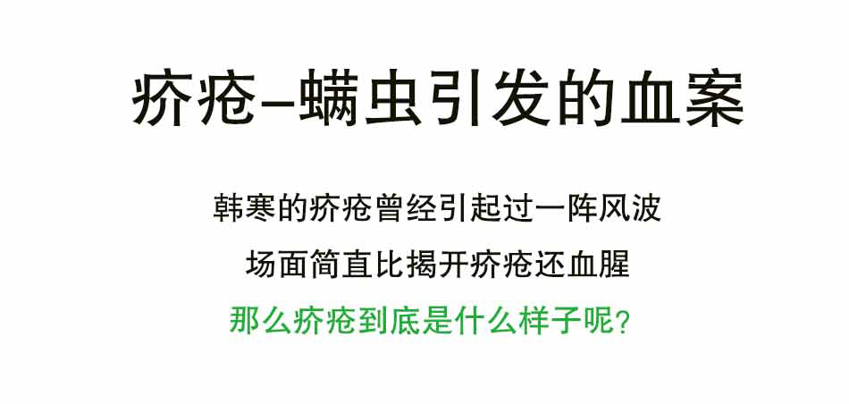 螨虫引发的凶案——疥疮_01.jpg