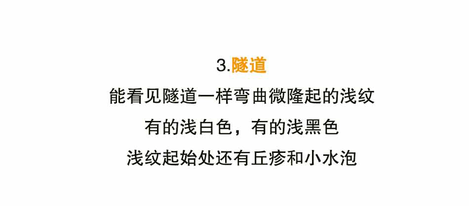 螨虫引发的凶案——疥疮_08.jpg