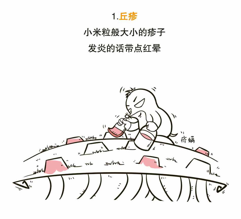 螨虫引发的凶案——疥疮_05.jpg