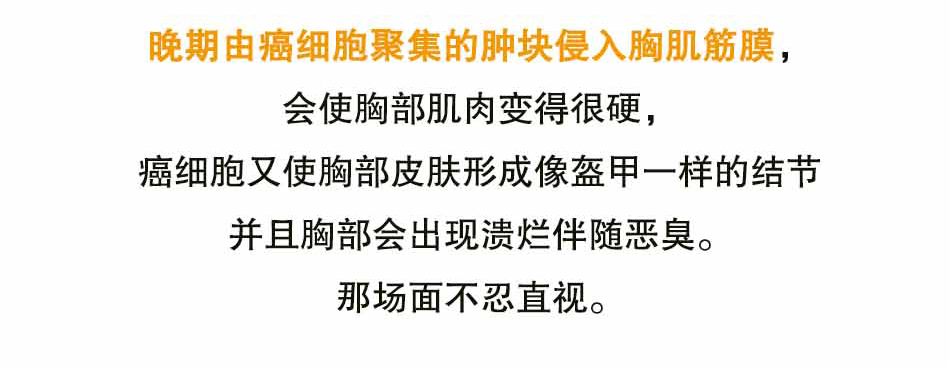 关注乳腺癌，关注女性健康_13.jpg