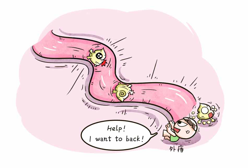 痔疮的三大难言之隐_16.jpg
