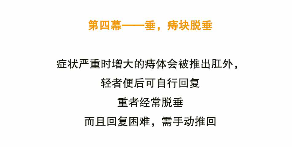 痔疮的三大难言之隐_15.jpg