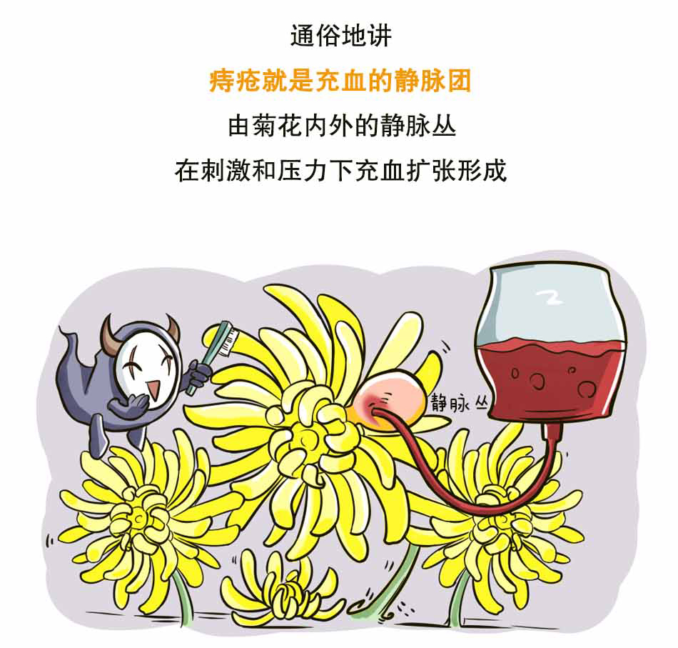 痔疮的三大难言之隐_05.jpg